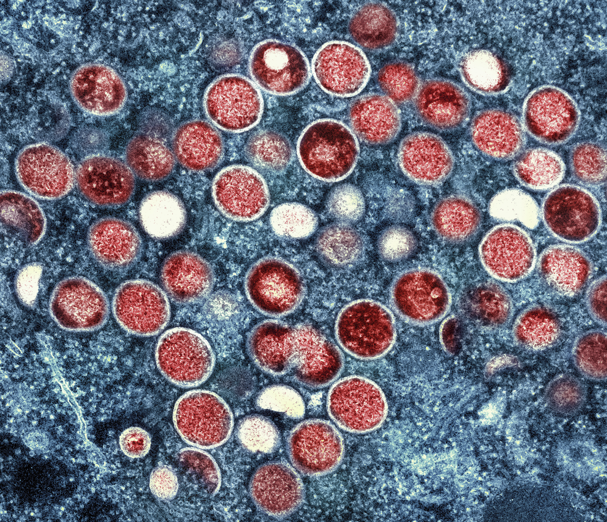 A microscopic image of cells