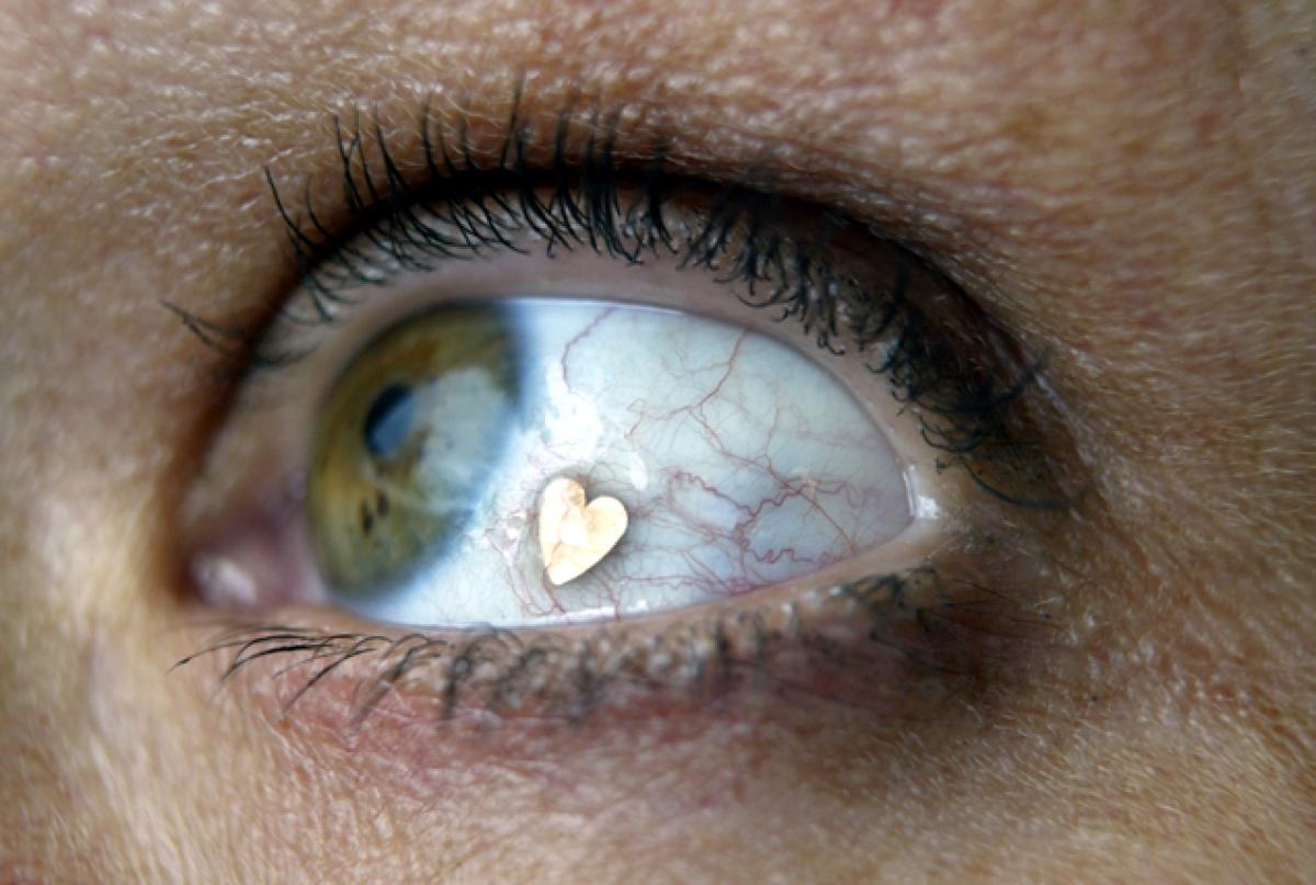 Eye