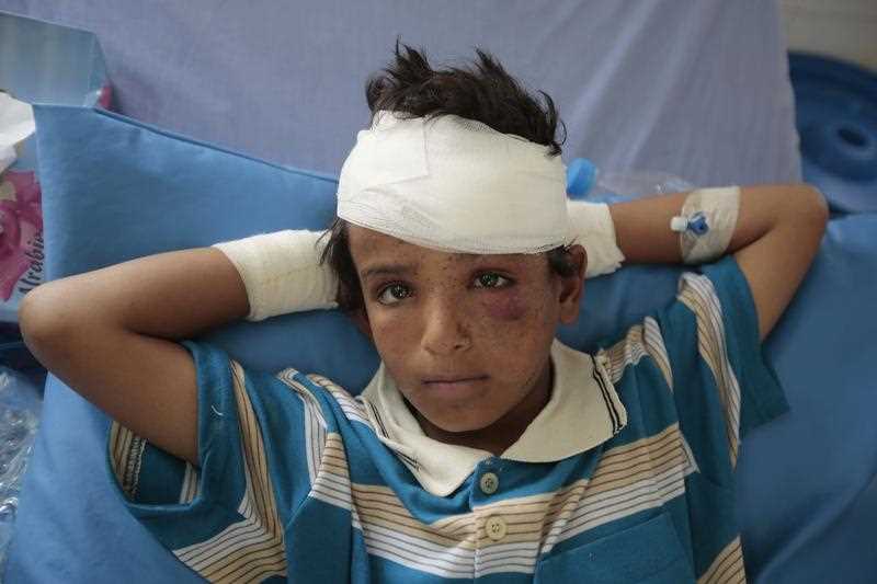 In this Aug. 12, 2018, file photo, a child injured in a deadly Saudi-led coalition airstrike on Thursday rests in a hospital in Saada, Yemen. 