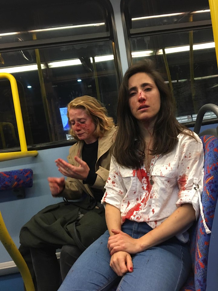 Melania Geymonat and her date Chris say they were left bloodied and needed hospital treatment