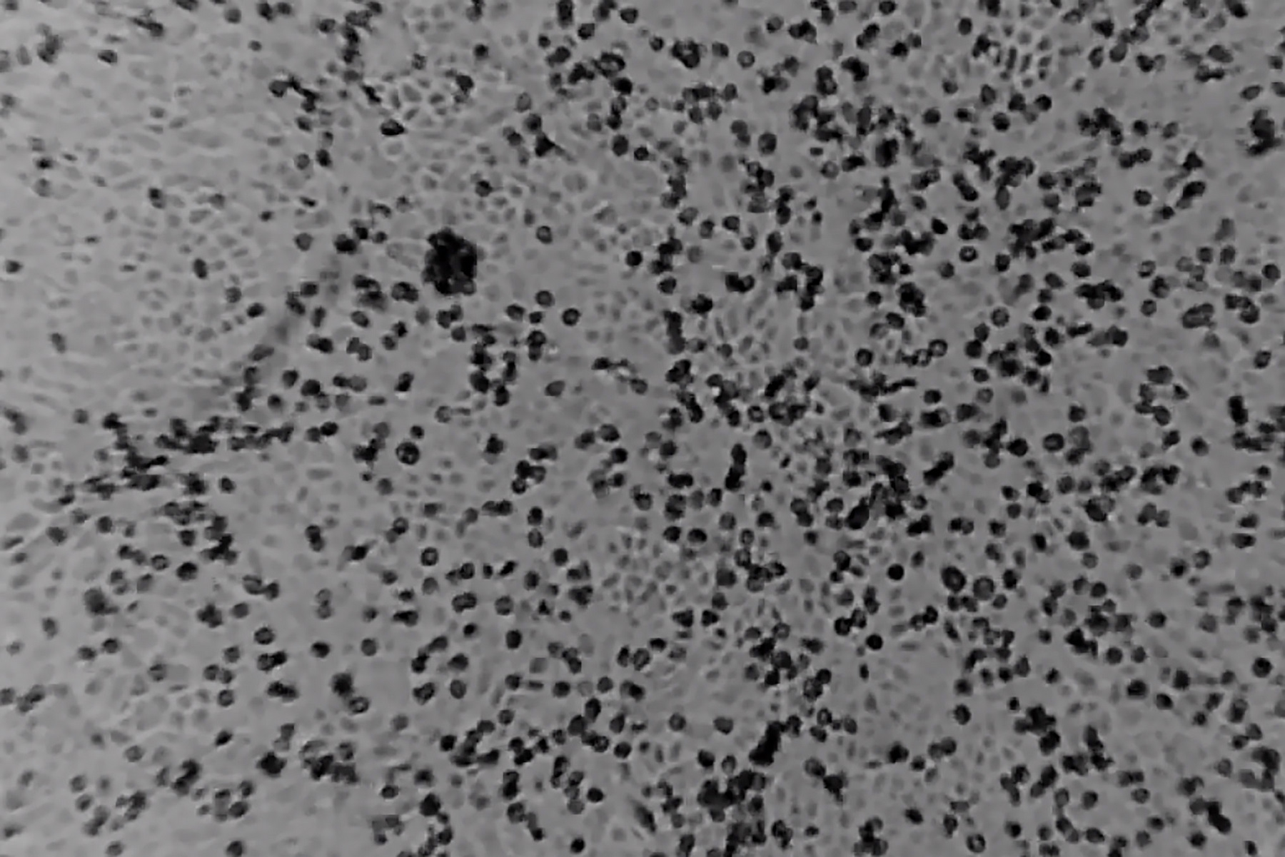 Novel Coronavirus