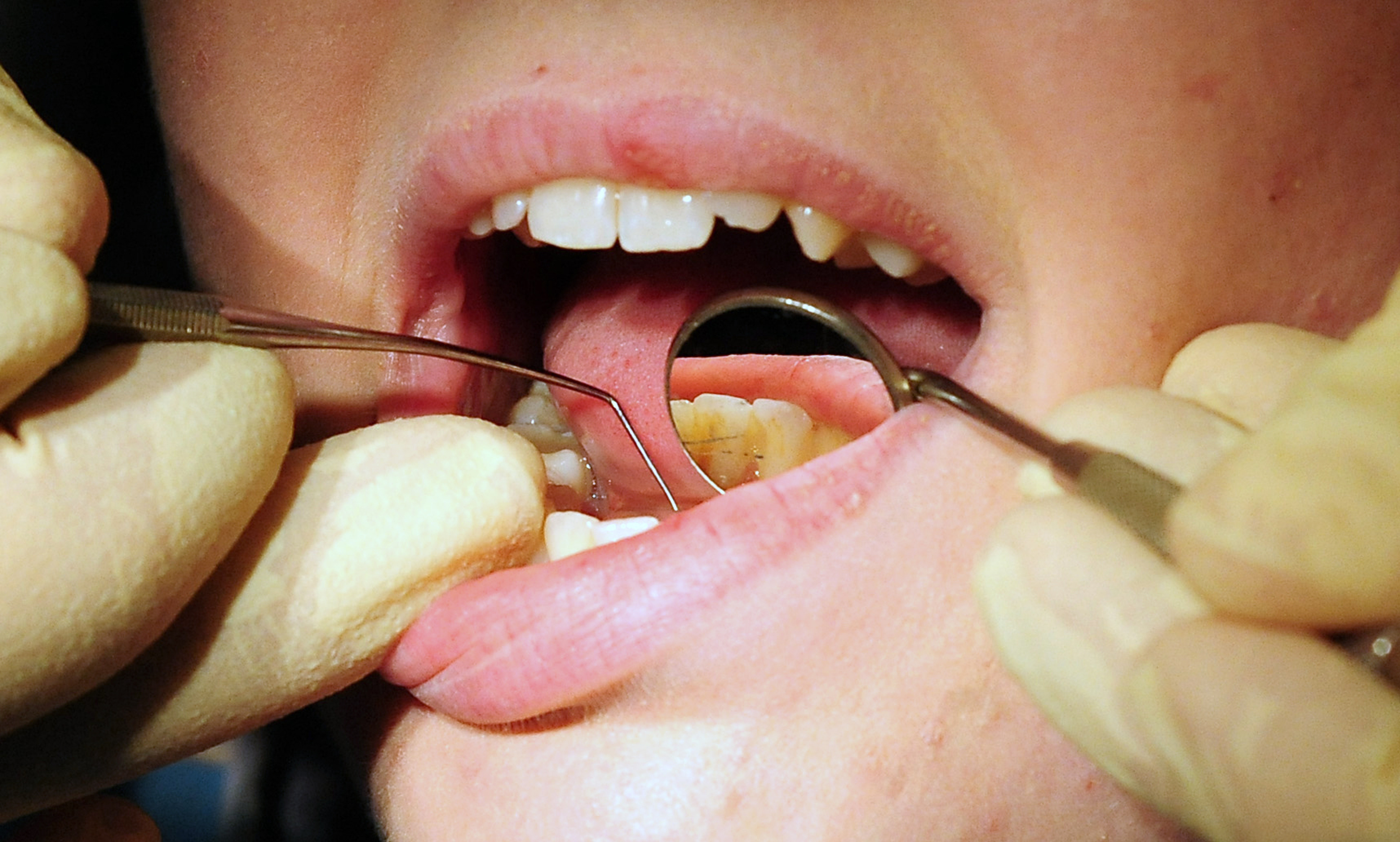 Dental care abroad